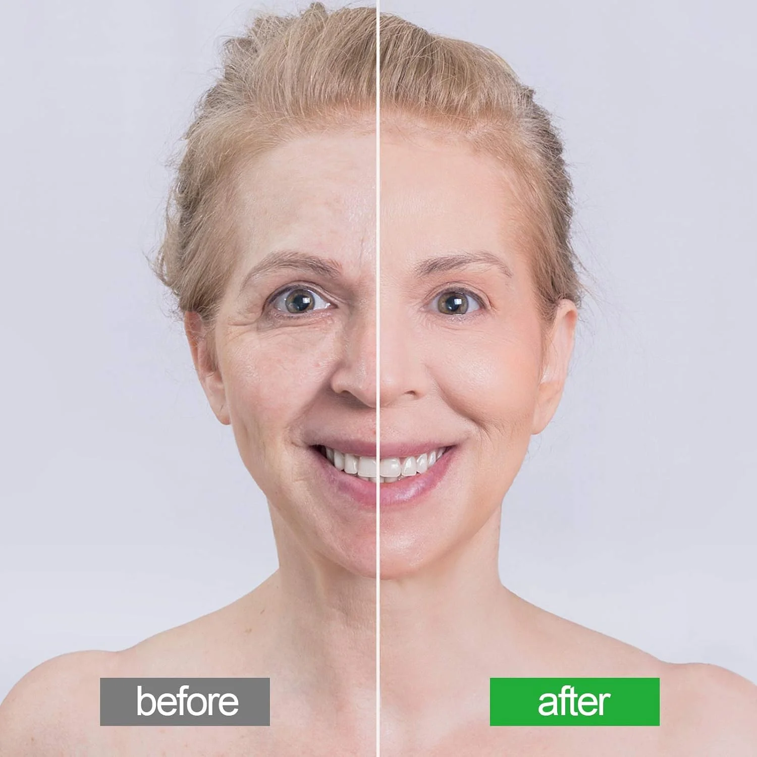 پدهای رفع چین و چروک صورت برای پیشانی، گردن و سینه، درمان صاف کننده سیلیکونی پوست صورت، قابل استفاده مجدد، استفاده آسان در طول شب