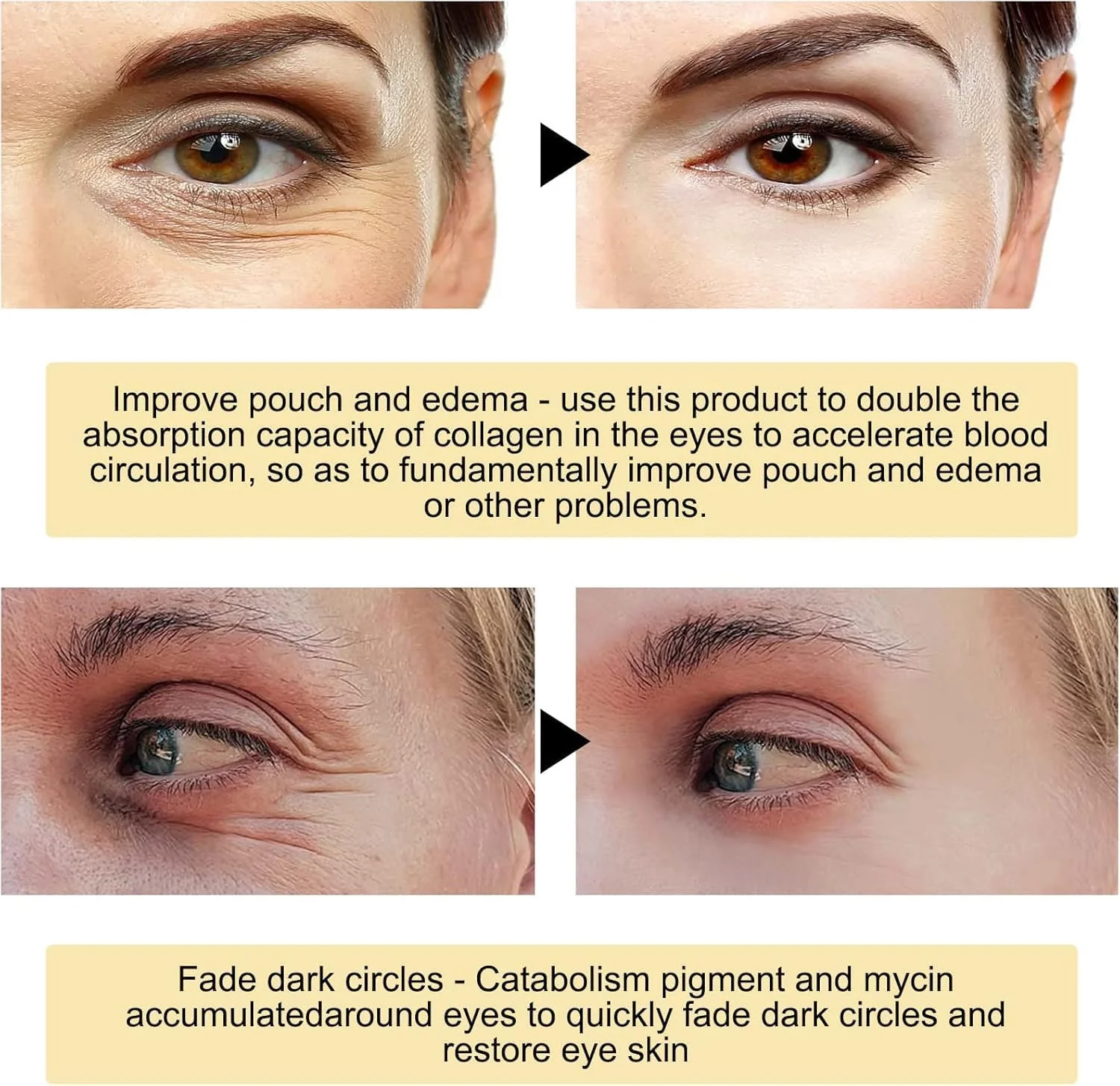 ماسک لوکس دور چشم با طلای 24 عیار - غنی شده با کلاژن و هیالورونیک اسید، کاهش دهنده سیاهی، پف و چین و چروک، ایجاد اثر مرطوب کنندگی طولانی مدت، افزایش درخشندگی ناحیه دور چشم ماسک لوکس دور چشم با طلای 24 عیار - غنی شده با کلاژن و هیالورونیک اسید، کاهش دهنده سیاهی، پف و چین و چروک، ایجاد اثر مرطوب کنندگی طولانی مدت، افزایش درخشندگی ناحیه دور چشم