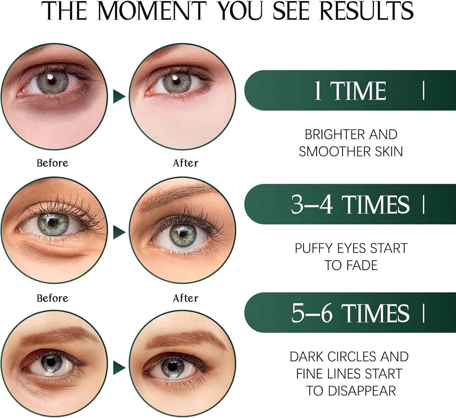 پدهای زیر چشم Tiepetly، ماسک چشم کلاژن، پدهای چشم چای سبز برای پف زیر چشم، 60 عدد، پدهای زیر چشم برای سیاهی و پف، مراقبت از پوست آبرسان، پدهای ژلی چشم برای چشم