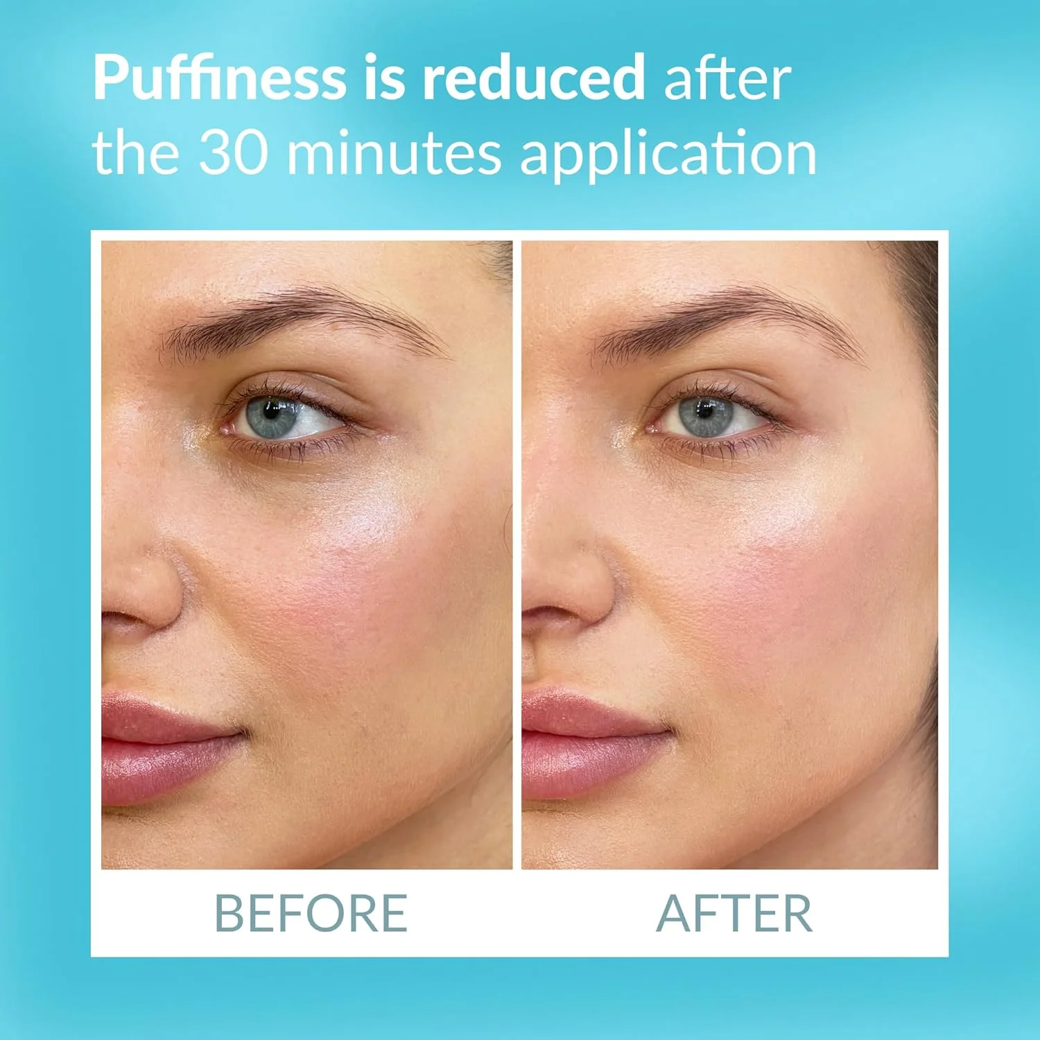 پد چشم درمانی تالیکا - پد فوری صاف کننده چشم - ماسک چشم برای سیاهی و پف زیر چشم - پدهای زیر چشم قابل استفاده مجدد - اثر فوری - 6 جفت پد چشم