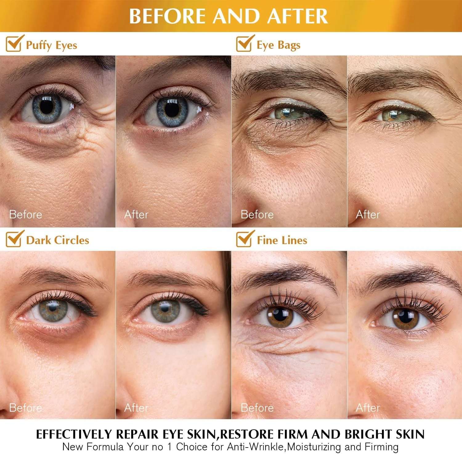 پدهای زیر چشم Enaskin Naturals برای سیاهی و پف زیر چشم - پدهای ژلی طلای 24 عیار، رتینول، کلاژن و اسید هیالورونیک، مرطوب کننده و کاهش دهنده چروک (طلای 24 عیار)