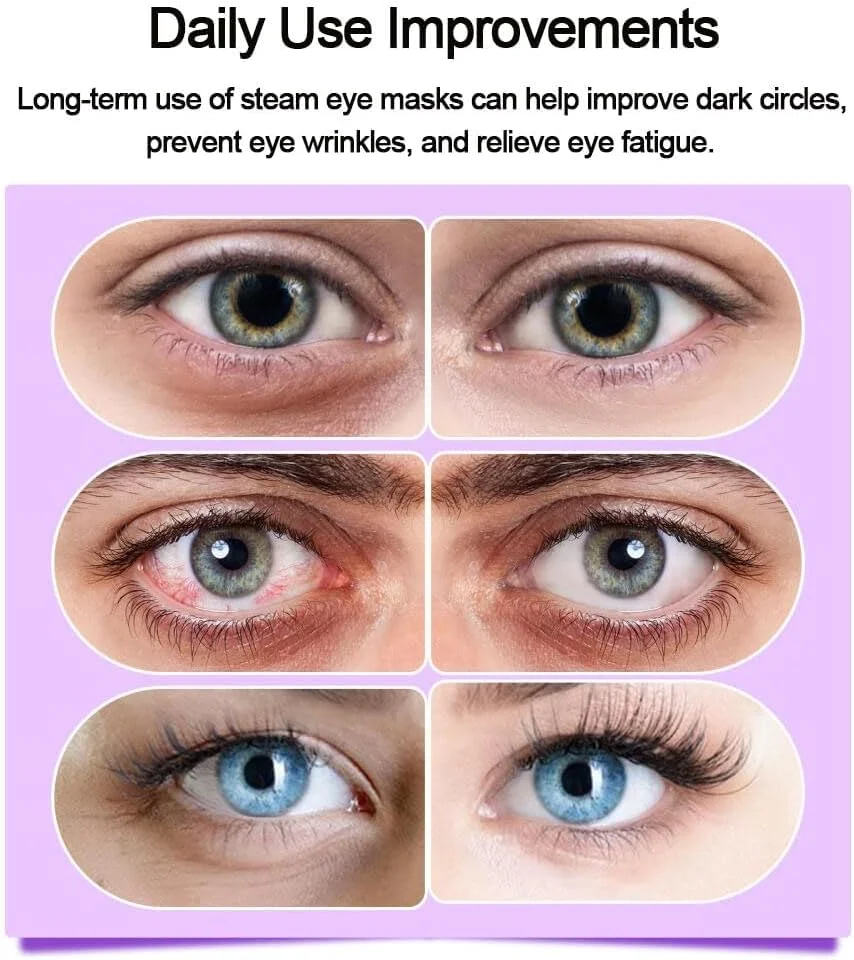 ماسک چشم بخار گرم - کمپرس گرم برای تسکین خشکی چشم و سیاهی دور چشم، ماسک خواب خودگرم شونده برای مسافرت/خانه/محل کار (یکبار مصرف) - بسته 10 عددی