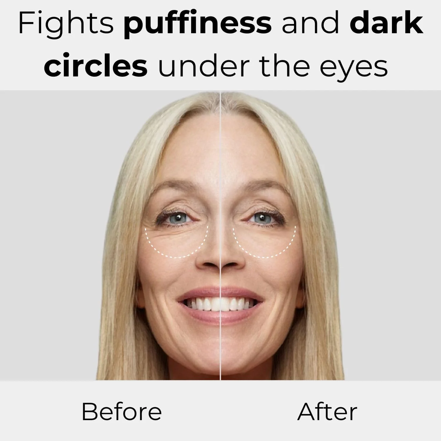 سرم دور چشم مجیک کر ام. آسـام (25 میلی لیتر) - ضد تیرگی و پف، سرم با اثر سفت کنندگی 360 درجه و هیالورونیک اسید