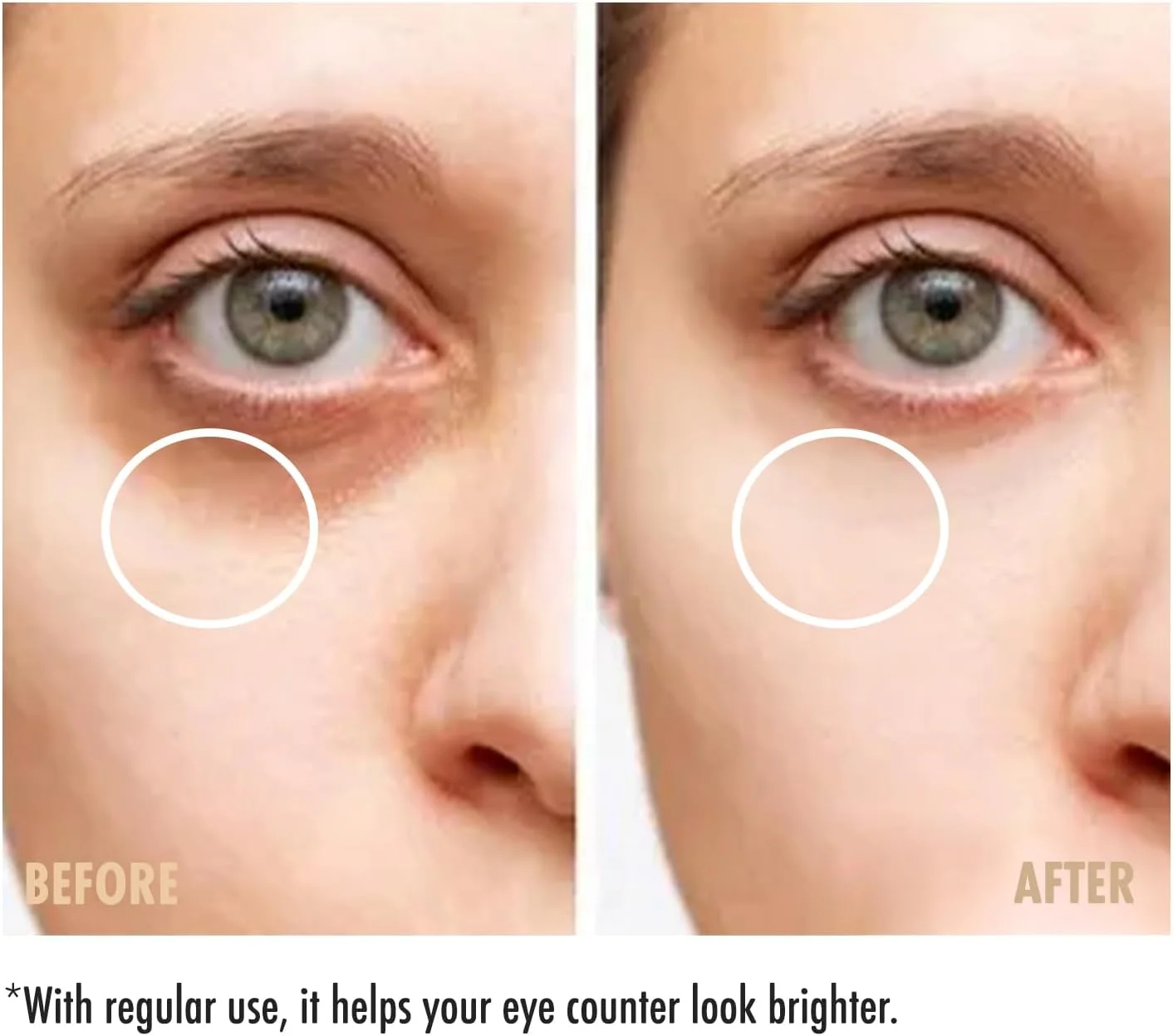 سرم دور چشم کافئین مارودرم 30 میلی لیتر