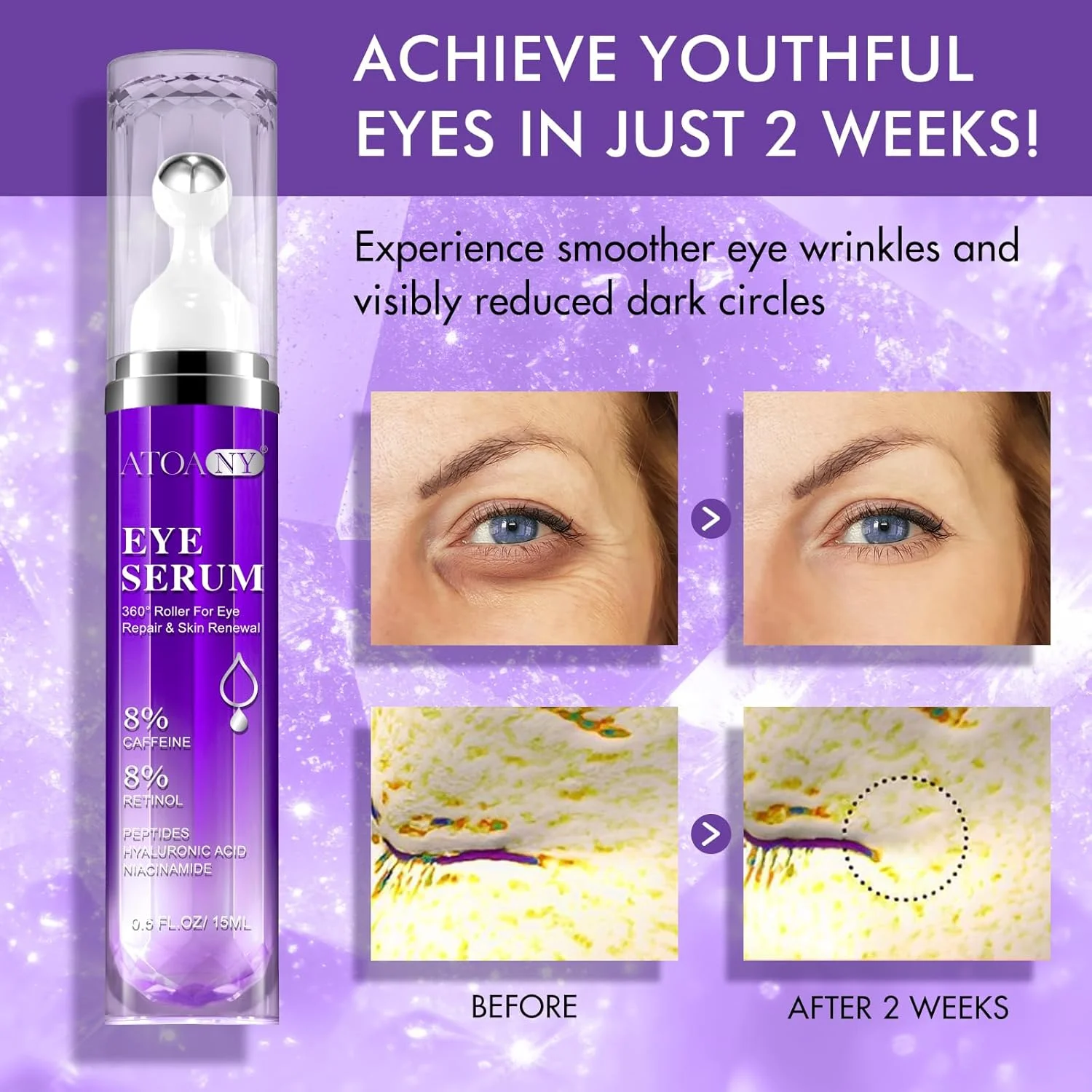 سرم دور چشم برای رفع تیرگی و پف با 8% کافئین، 8% رتینول، هیالورونیک اسید و نیاسینامید، کرم دور چشم ضد پیری با توپ ماساژ غلتکی 360 درجه برای زنان و مردان سرم دور چشم برای رفع تیرگی و پف با 8% کافئین، 8% رتینول، هیالورونیک اسید و نیاسینامید، کرم دور چشم ضد پیری با توپ ماساژ غلتکی 360 درجه برای زنان و مردان