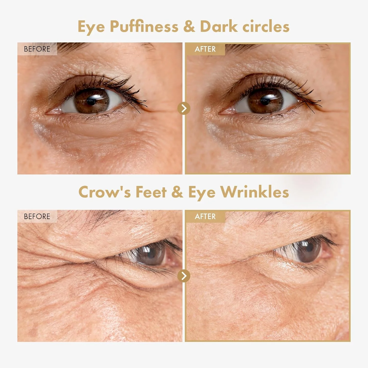 سرم دور چشم جینسینگ پلاس رتینال توسوونگ حاوی نیاسینامید و باکوچیول - مراقبت سبک کره‌ای برای ناحیه دور چشم با ظاهری صاف و شاداب، 30 میلی‌لیتر