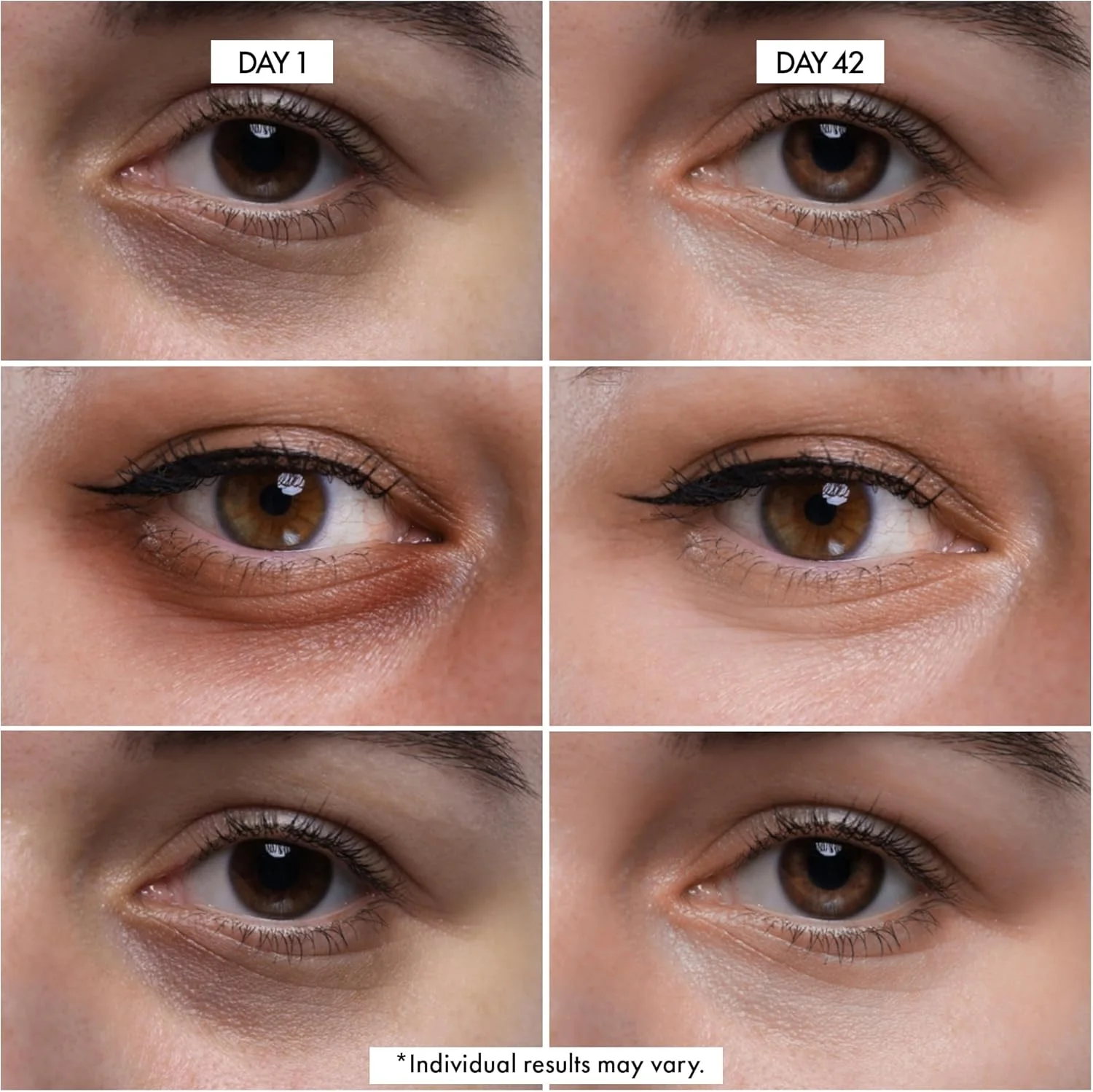 کرم دور چشم دکتر کریزی | کرم دور چشم برای سیاهی و پف زیر چشم | کرم ضد پیری حاوی پروبیوتیک، رتینول، کافئین و موارد دیگر | 30 میلی لیتر کرم دور چشم دکتر کریزی | کرم دور چشم برای سیاهی و پف زیر چشم | کرم ضد پیری حاوی پروبیوتیک، رتینول، کافئین و موارد دیگر | 30 میلی لیتر