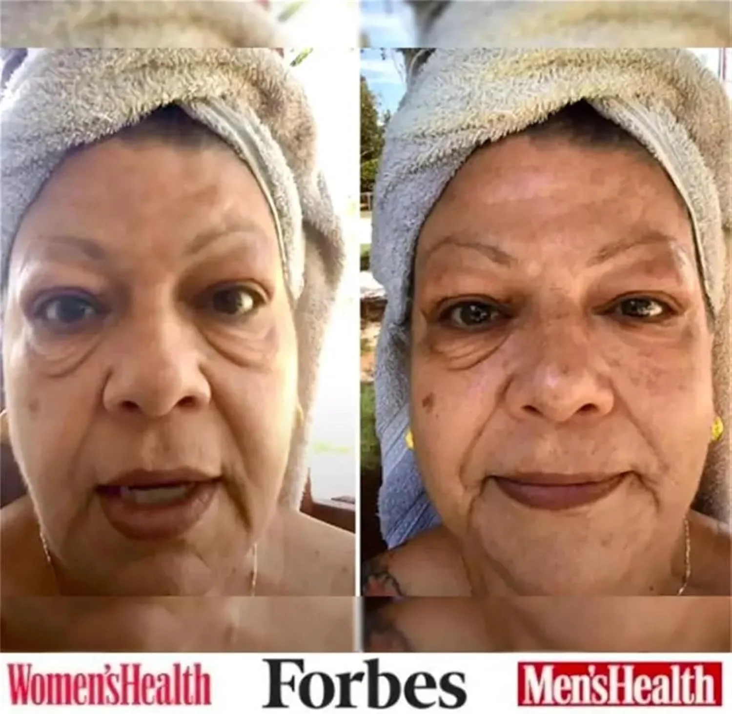 کرم دور چشم سلین برای رفع موقت پف و تیرگی دور چشم، سفت کننده و لیفتینگ