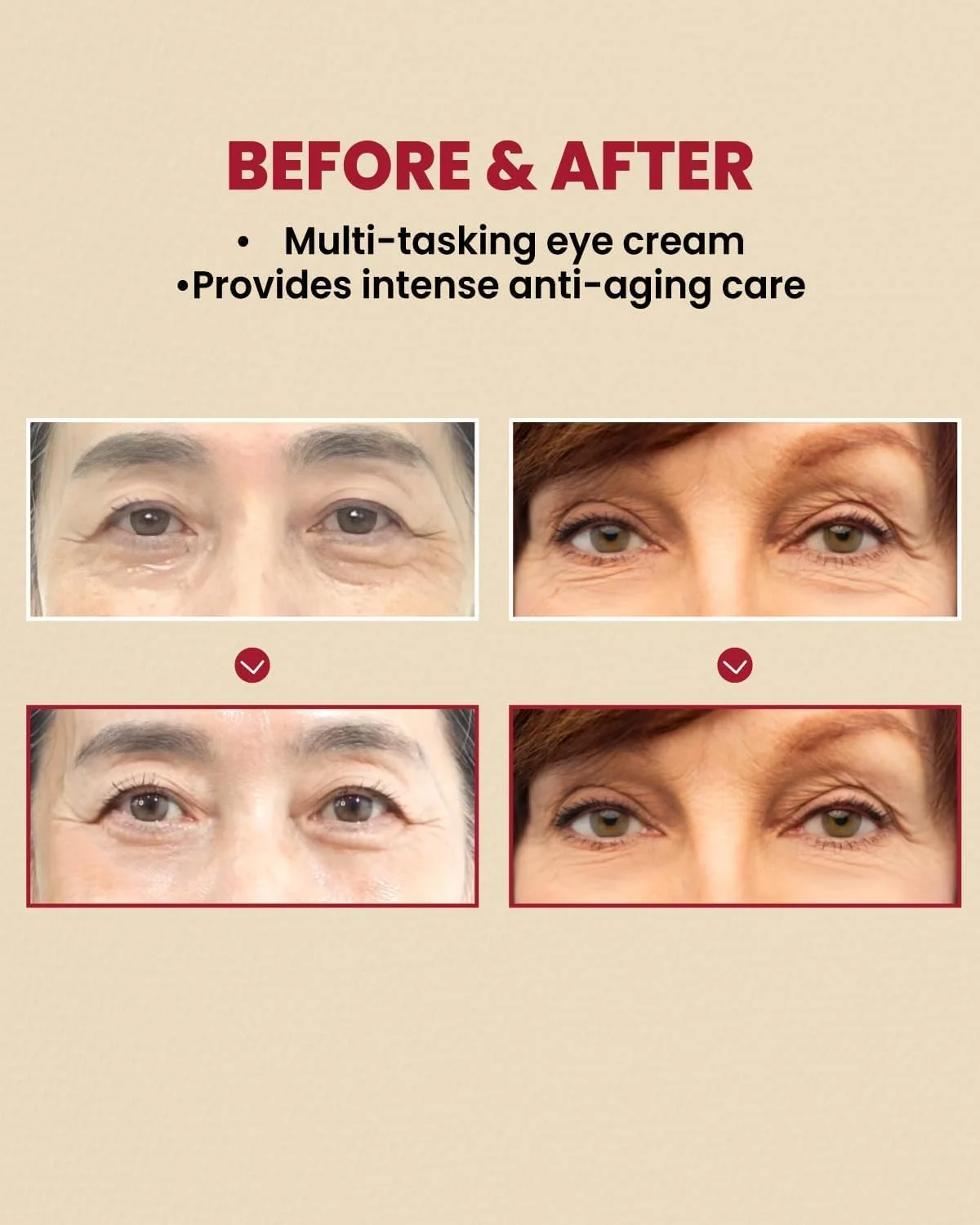 کرم دور چشم 2 عددی 1988: رتینال لیپوزوم 4% + لوبیای تخمیر شده