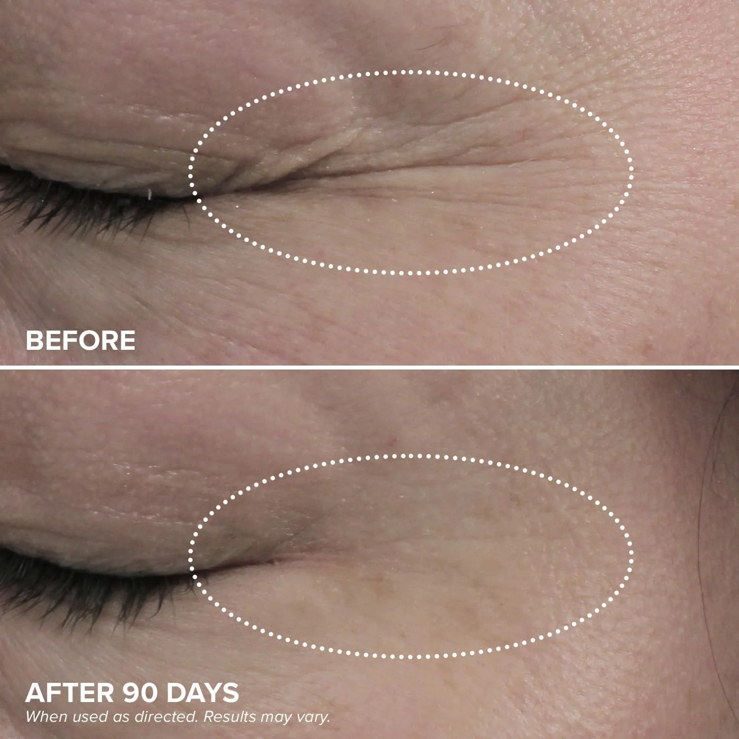 کرم دور چشم DRMTLGY HPR - کرم دور چشم رتینوئید برای زیر چشم، 15 میلی لیتر کرم دور چشم DRMTLGY HPR - کرم دور چشم رتینوئید برای زیر چشم، 15 میلی لیتر