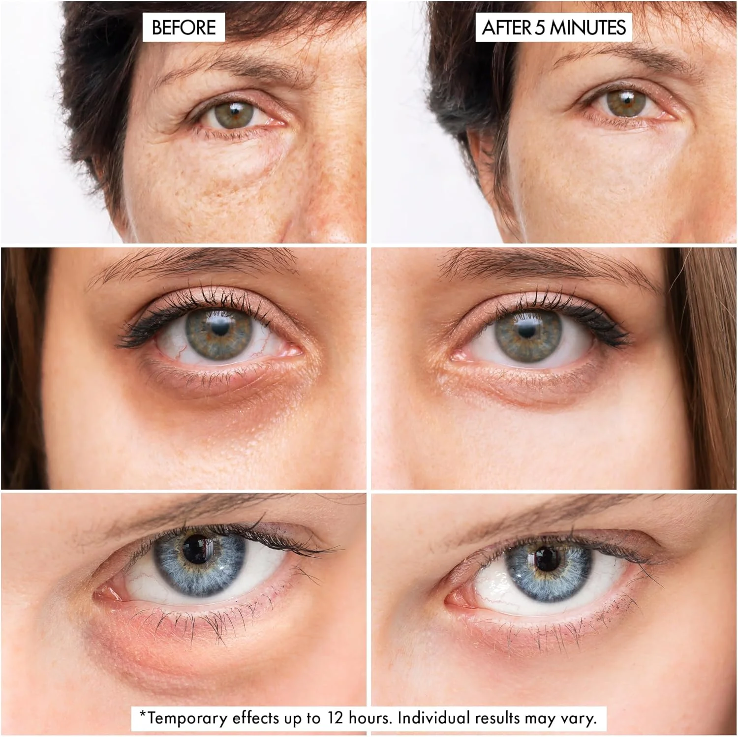 از بین برنده فوری پف زیر چشم دکتر کریزی - کرم ضد پیری زیر چشم برای حلقه های تیره و پف کردگی - لیفت سریع چشم و صورت - بدون پوسته پوسته شدن یا باقیمانده - 10 میلی لیتر