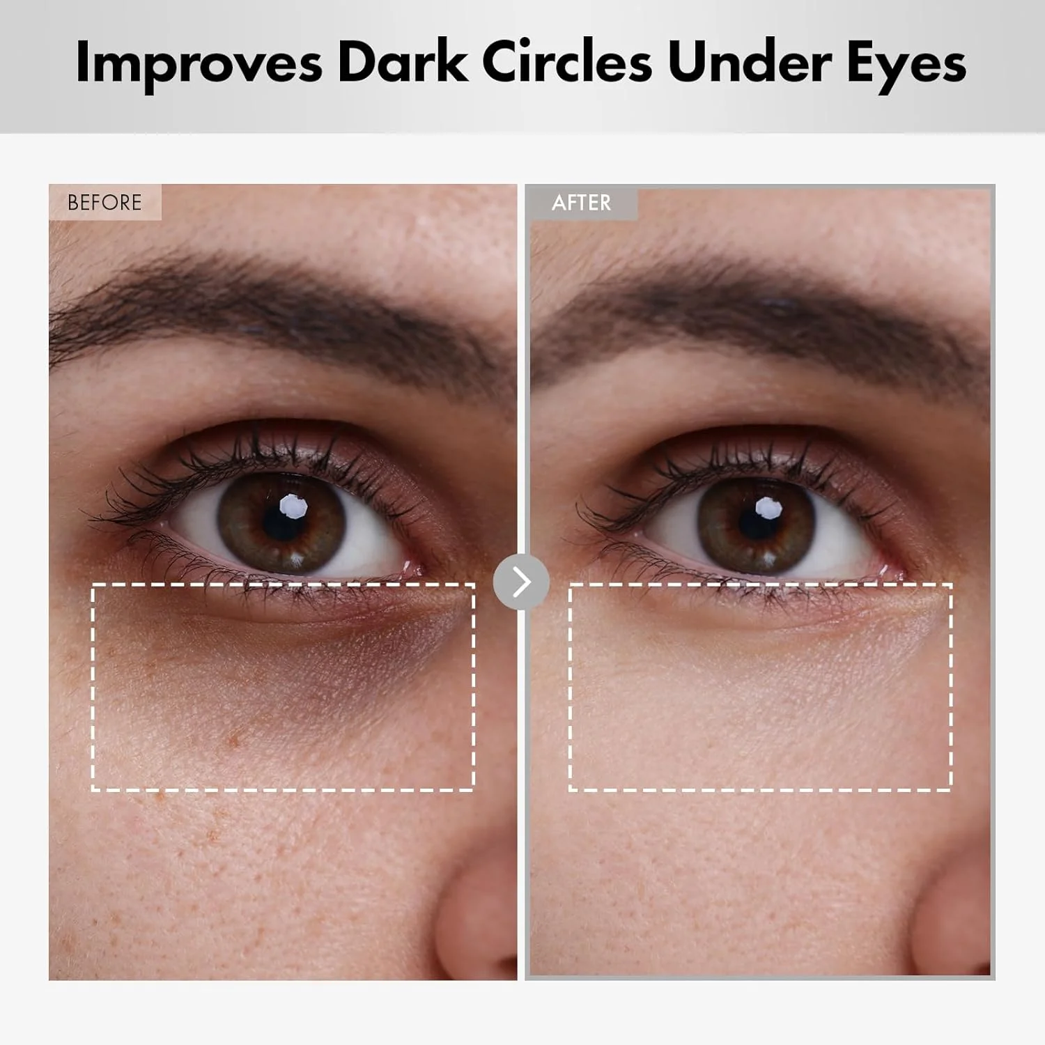 کرم دور چشم لیفتینگ هیالورون، حاوی هیالورونیک اسید، آربوتین 5%، نیاسینامید برای پف زیر چشم، لکه‌های تیره و خطوط ریز، آبرسان زیر چشم، مراقبت از پوست کره‌ای، 15 میلی‌لیتر