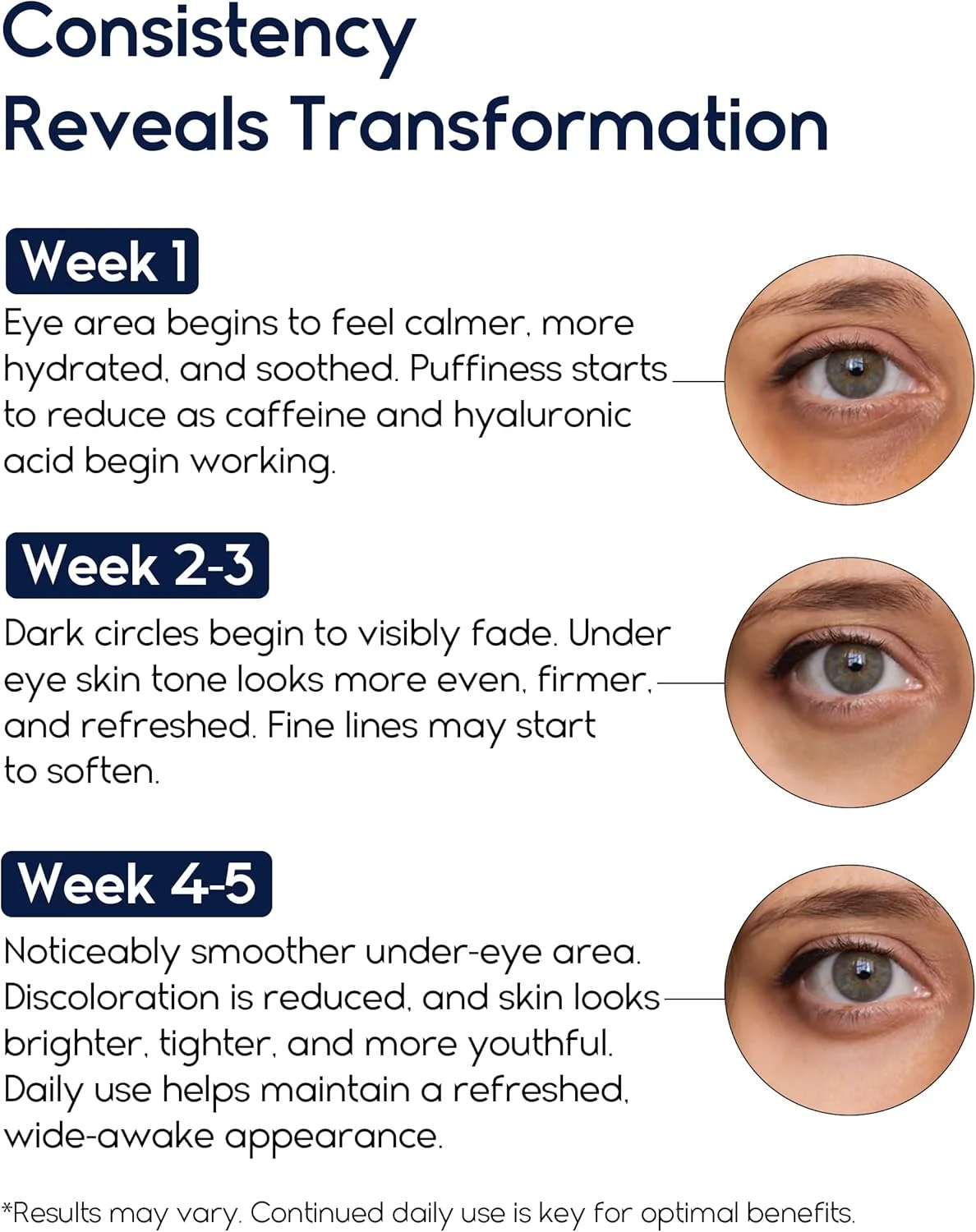 کرم دور چشم برای پف و سیاهی زیر چشم، درمان سیاهی دور چشم برای آقایان و بانوان - کرم ضد چروک برای حلقه های تیره، درمان پف زیر چشم برای بانوان حاوی رتینول، هیالورونیک اسید و کافئین