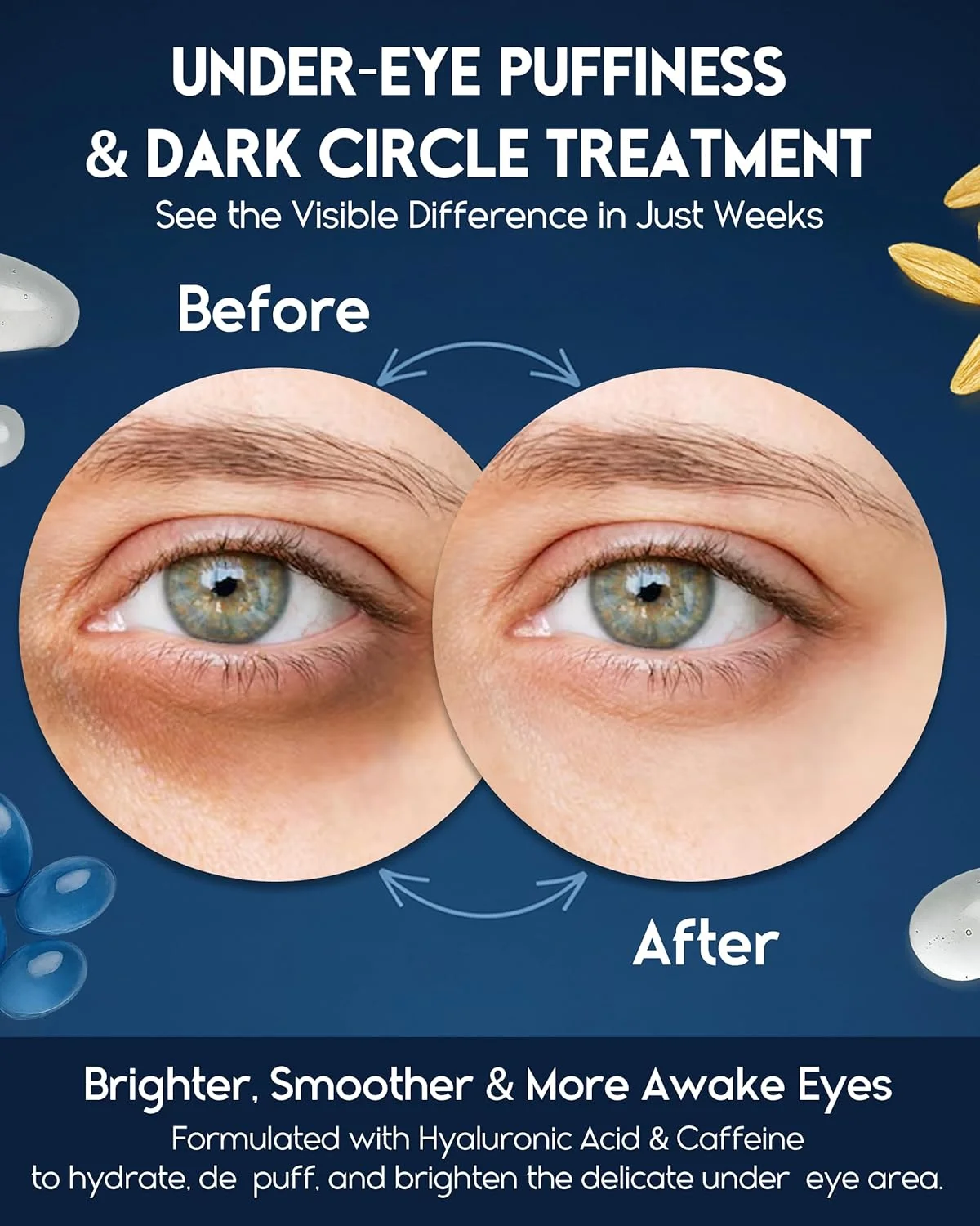 کرم دور چشم برای پف و سیاهی زیر چشم، درمان سیاهی دور چشم برای آقایان و بانوان - کرم ضد چروک برای حلقه های تیره، درمان پف زیر چشم برای بانوان حاوی رتینول، هیالورونیک اسید و کافئین