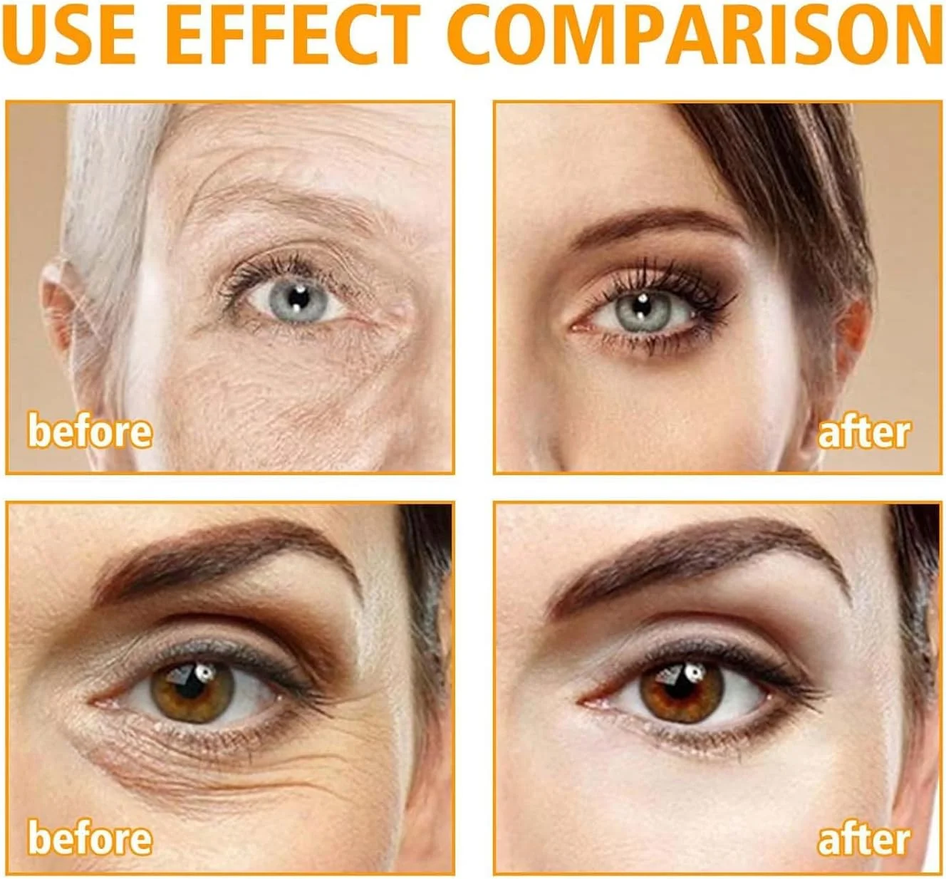 کرم دور چشم، کرم ترمیم کننده دور چشم 5D پپتید، کرم تسکین دهنده فوری دور چشم، مراقبت فشرده دور چشم، کاهش خطوط ریز و از بین برنده پف زیر چشم (2 عدد)