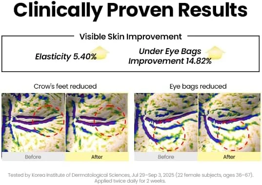 کرم دور چشم K-SECRET SEOUL 1988: رتینال لیپوزوم 4% + لوبیای تخمیر شده