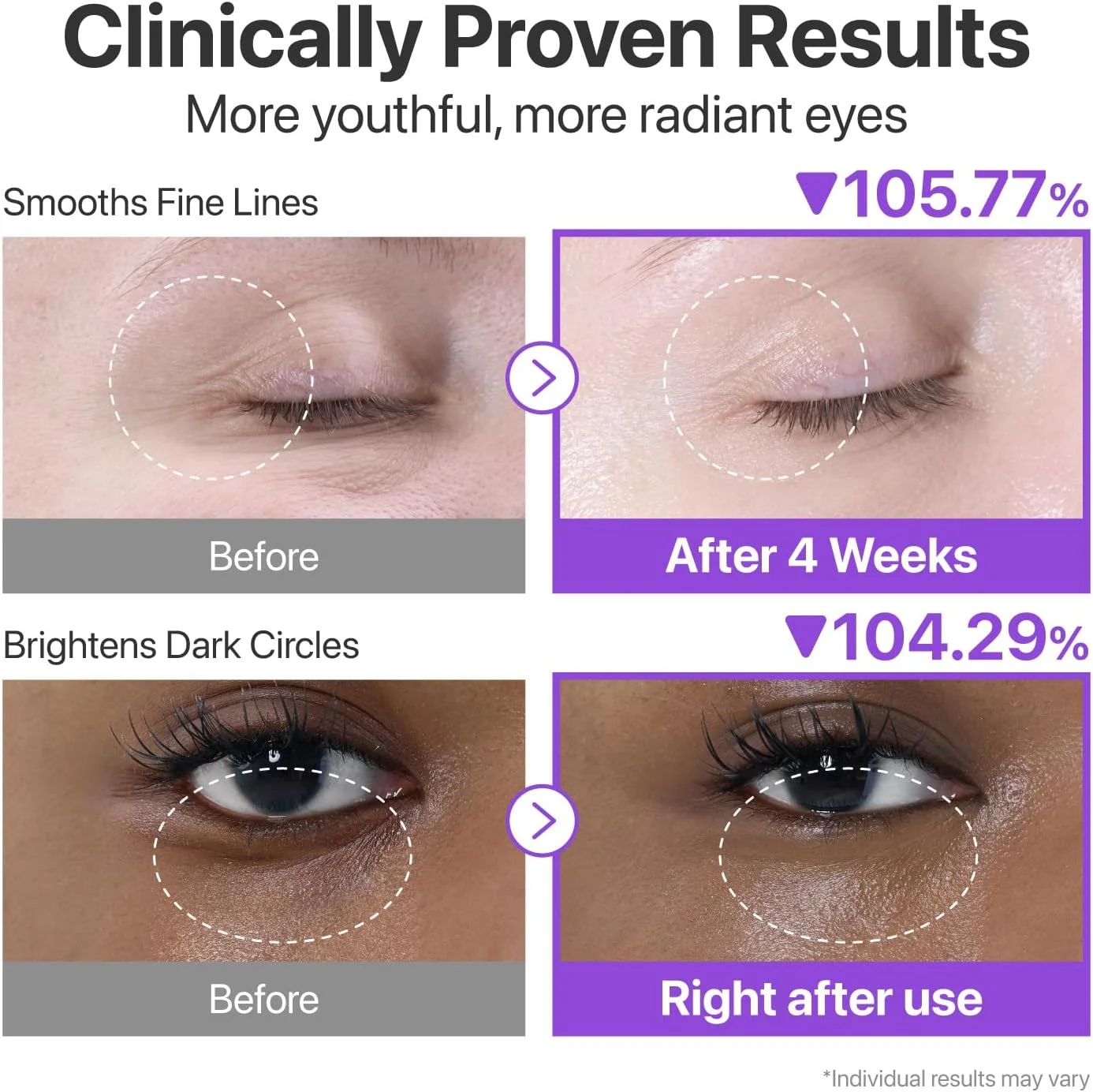 کرم دور چشم شماره 9 نامبرزین | کرم دور چشم حجم دهنده NAD+ رتینول | سفت کننده، ضد چروک، ضد خطوط ریز، ضد تیرگی، ضد پف | رتینول، پپتیدها، نیاسینامید | سرم درمان زیر چشم | 0.33 fl. oz.