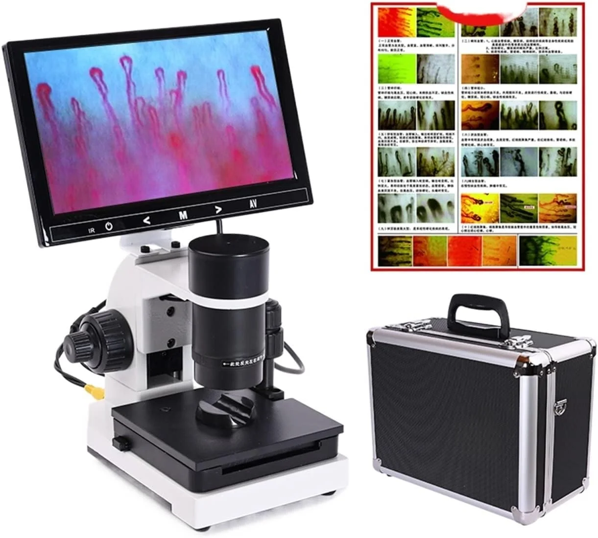 میکروسکوپ حرفه ای ناخن تاشو مویرگی میکروسیرکولاسیون USB HD دیجیتال خون + نمایشگر LCD رنگی 7 یا 9 اینچی (صفحه نمایش LCD 9 اینچی) میکروسکوپ حرفه ای ناخن تاشو مویرگی میکروسیرکولاسیون USB HD دیجیتال خون + نمایشگر LCD رنگی 7 یا 9 اینچی (صفحه نمایش LCD 9 اینچی)