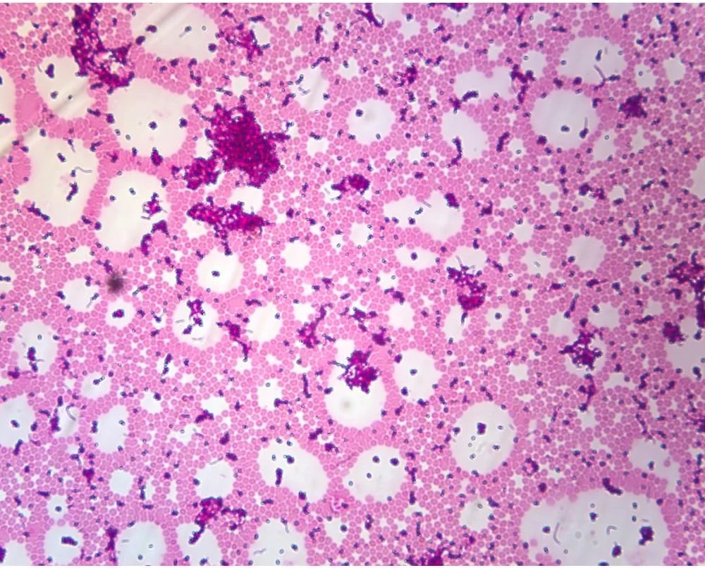 اسلاید میکروسکوپ رنگ آمیزی اسید فست