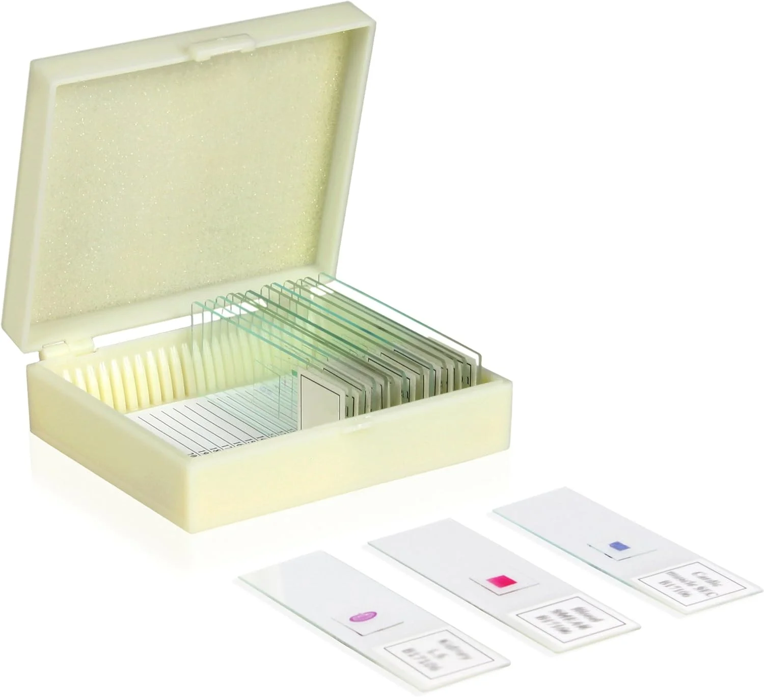 اسلاید آماده بیماری های خطرناک انسانی Vision Scientific VSH116، مجموعه 10 عددی