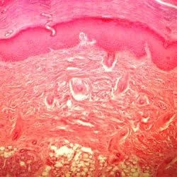 مجموعه اسلایدهای آماده میکروسکوپ Vision Scientific VSH112 – فیزیولوژی انسان (مجموعه 16 عددی) | اسلایدها به وضوح برای شناسایی آسان برچسب گذاری شده اند | نمونه ها با لایه محافظ پوشانده شده اند