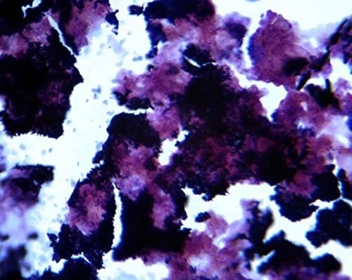 اسلاید آماده بیماری های خطرناک انسانی Vision Scientific VSH116، مجموعه 10 عددی