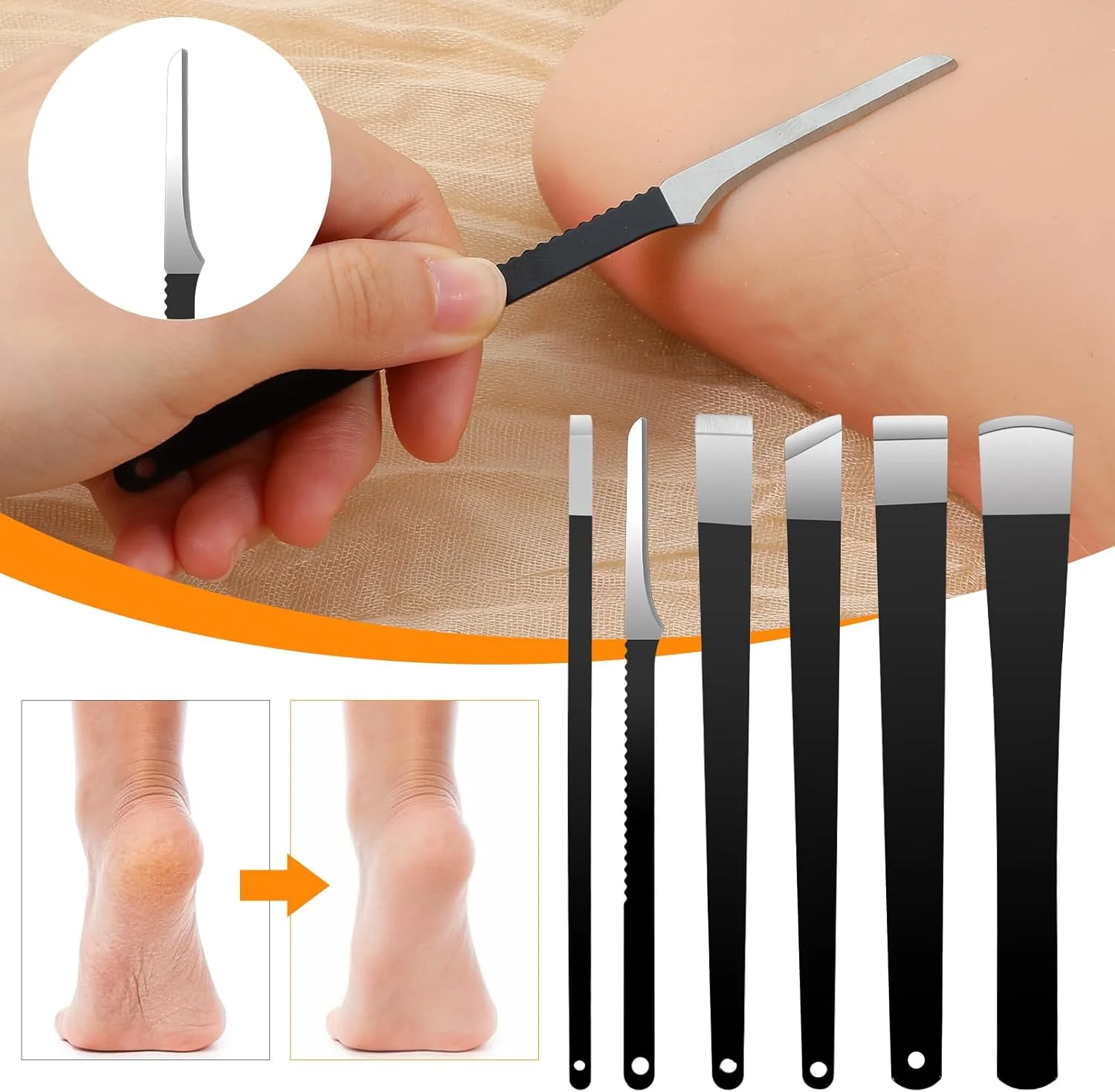 ست ۶ عددی چاقوی پدیکور، ابزار ناخن پا فرورفته به همراه جعبه نگهداری، کیت لایه بردار پینه، ابزار حرفه ای پدیکور برای پا، ابزار تمیز کننده ناخن پا برای مراقبت از پا سوهان ذرت پوست مرده