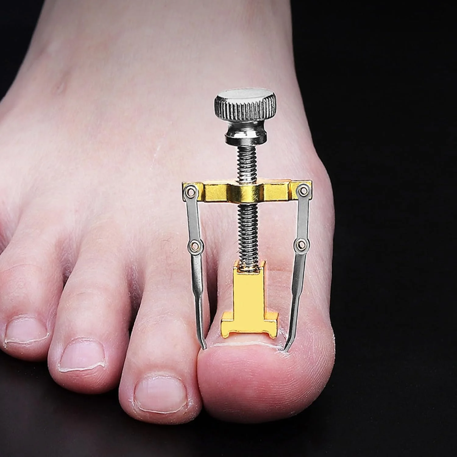 ست چاقوی پدیکور ناخن فرورفته NALACAL، اصلاح کننده ناخن فرورفته برای پینه و میخچه (1) استیل ضد زنگ