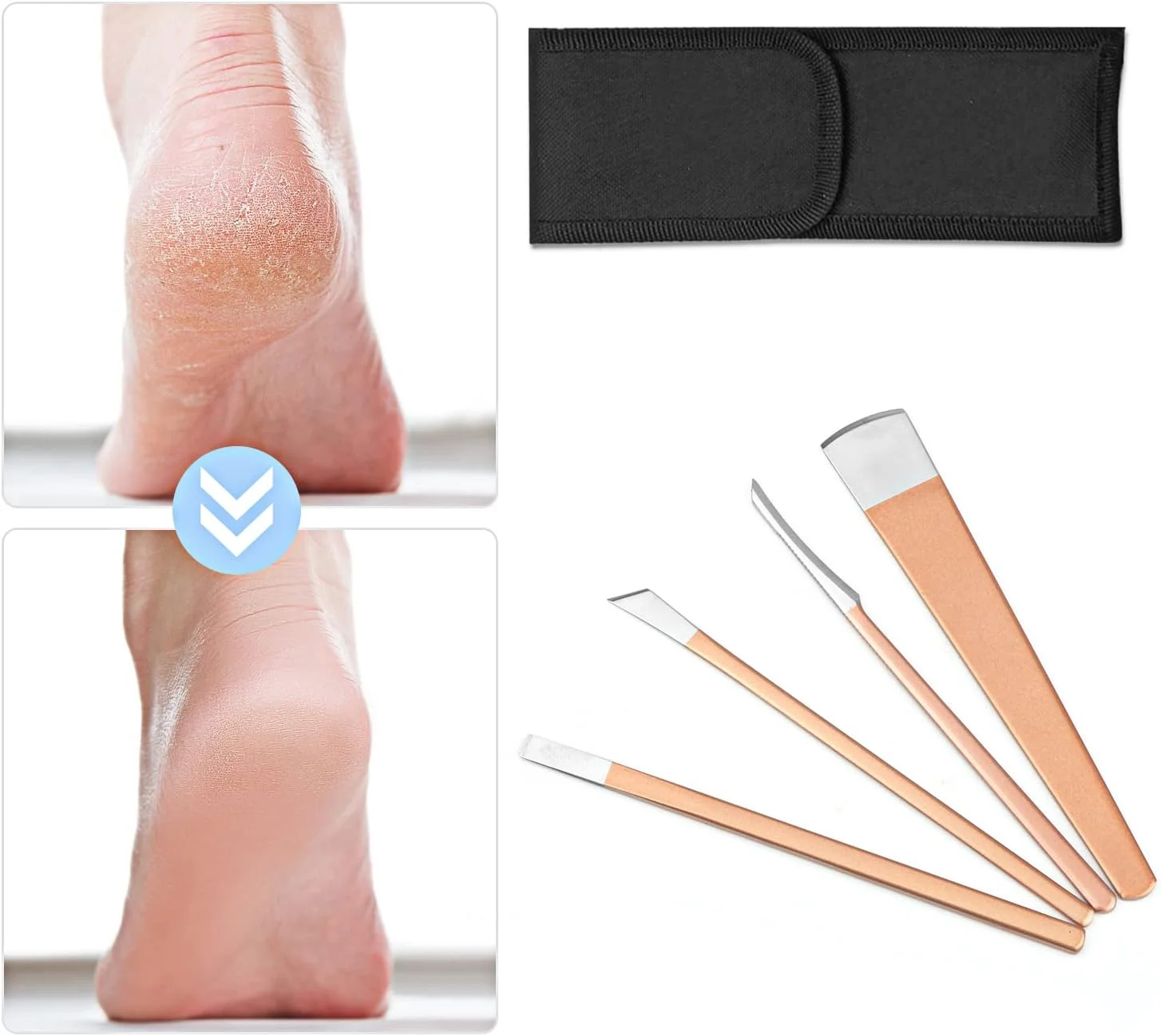 ست ۴ عددی چاقوی پدیکور کوسیتینا، ابزار حرفه ای چاقوی ناخن پا فرورفته، چاقوهای استیل ناخن، کیت حذف کننده کوتیکول، تیغه تعمیر پا با کیف نگهداری برای سالن زیبایی خانگی - رزگلد