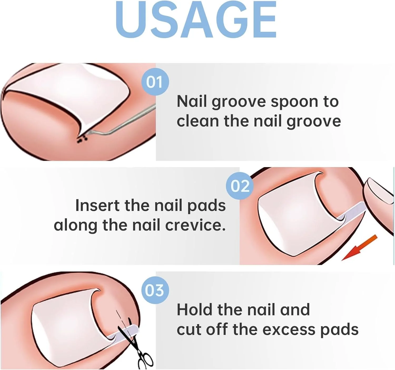 ست ناخن های فرورفته در گوشت، گیره اصلاح ناخن، کیت ناخن های فرورفته در گوشت، گیره اصلاح ناخن یکبار مصرف، برای اصلاح رشد ناخن های فرورفته در گوشت، مراقبت از پا، بسته 40 عددی