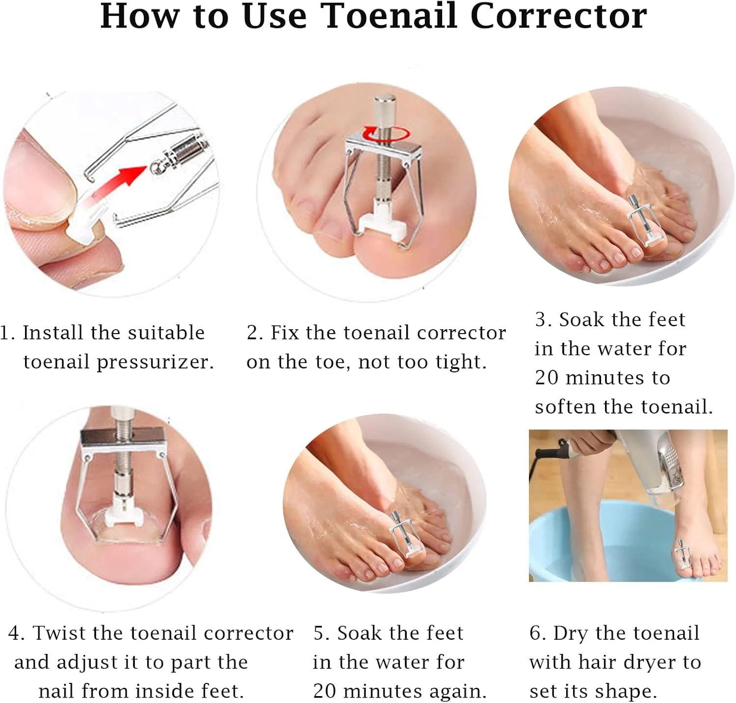 کیت درمان ناخن فرورفته، صاف کننده و اصلاح کننده ناخن پا، ابزار برداشتن ناخن کیت درمان ناخن فرورفته، صاف کننده و اصلاح کننده ناخن پا، ابزار برداشتن ناخن