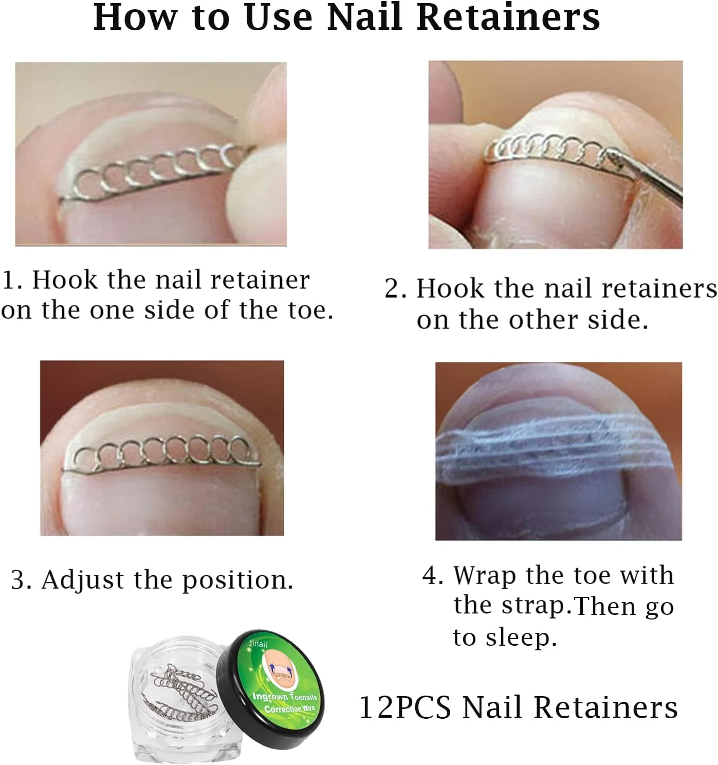 کیت درمان ناخن فرورفته، صاف کننده و اصلاح کننده ناخن پا، ابزار برداشتن ناخن کیت درمان ناخن فرورفته، صاف کننده و اصلاح کننده ناخن پا، ابزار برداشتن ناخن