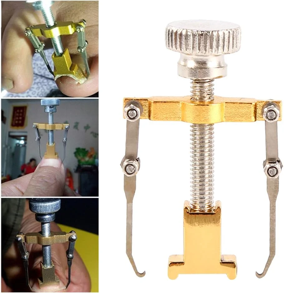 ابزار اصلاح ناخن فرورفته یوسو، ست ابزار حرفه ای درمان ناخن پا برای پارونیشیا (ابزار اصلاح ناخن فرورفته)