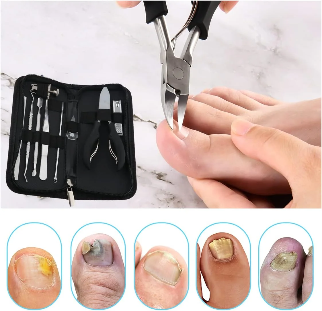 ست ابزار 10 عددی ناخن پا فرورفته، ابزار حرفه ای پدیکور و درمان ناخن، قیچی های درجه جراحی