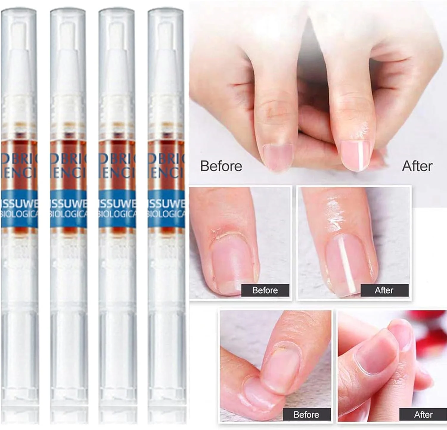 قلم ترمیم ناخن، ست 4 عددی ترمیم ناخن، درمان ناخن ترک خورده، تقویت کننده ناخن های آسیب دیده، آبرسانی لایه های بیرونی، کاربرد چند منظوره برای ناخن های دست و پا، نفوذ عمیق