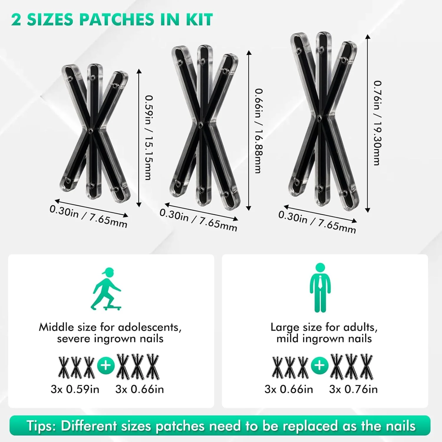 ابزار سه گانه اصلاح ناخن فرورفته، کیت درمان سریع ناخن فرورفته در خانه، اصلاح انحنا برای ناخن شست پا، میله های لیفت کننده ناخن