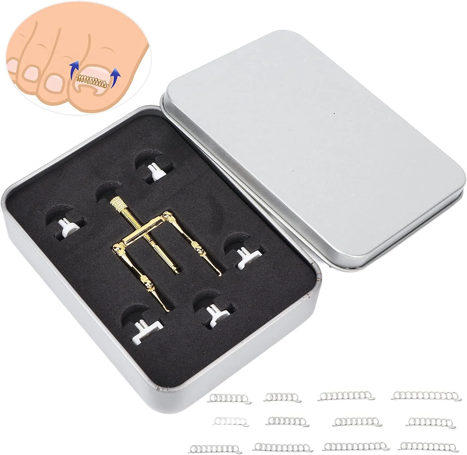 کیت درمان ناخن فرورفته در گوشت، گیره استیل ضد زنگ حرفه ای اصلاح کننده ناخن فرورفته در گوشت به همراه جعبه نگهداری و 12 عدد سیم اصلاح کننده ناخن فرورفته در گوشت