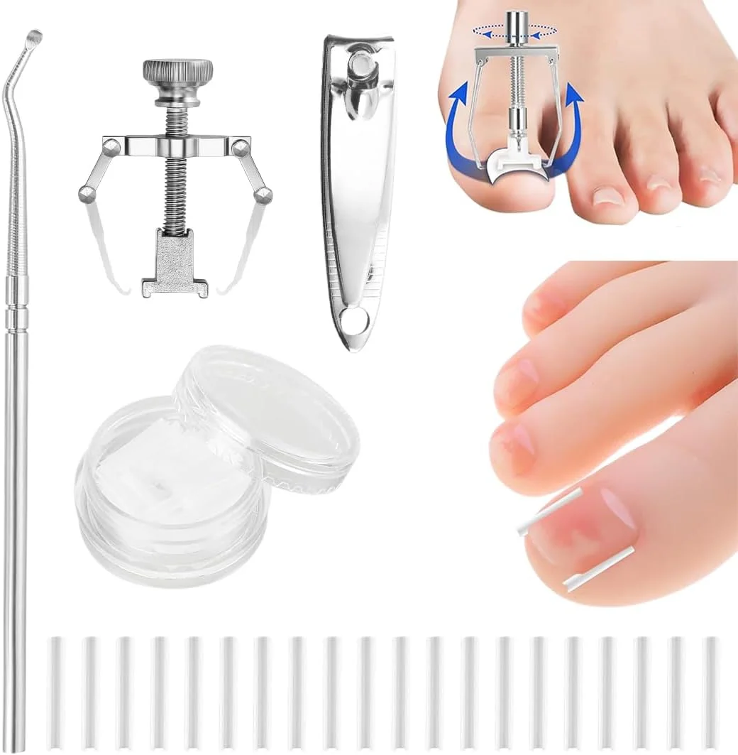 کیت اصلاح ناخن مدل Ingrown Toenail بسته 50 عددی