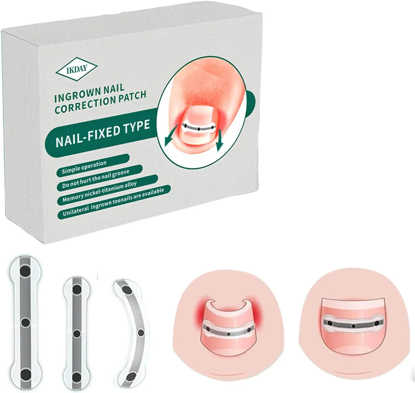 ست برداشتن ناخن فرورفته | ابزار پدیکور پا، ابزار ناخن مخصوص طراحی شده برای ترمیم ناخن های خمیده و اصلاح کننده ناخن فرورفته (1.7/2 سانتی متر)