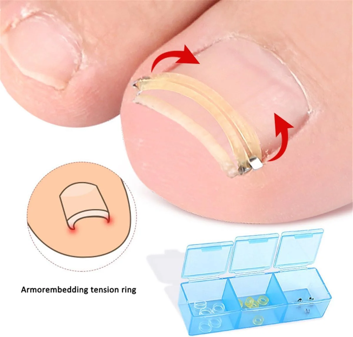 صاف کننده ناخن پا فرورفته - صاف کننده ناخن منحنی از جنس استیل ضد زنگ به همراه کش های لاستیکی، کیت رفع ناخن پا فرورفته، ابزار حرفه ای پدیکور برای آقایان و بانوان، ترمیم ناخن منحنی (نقره ای)