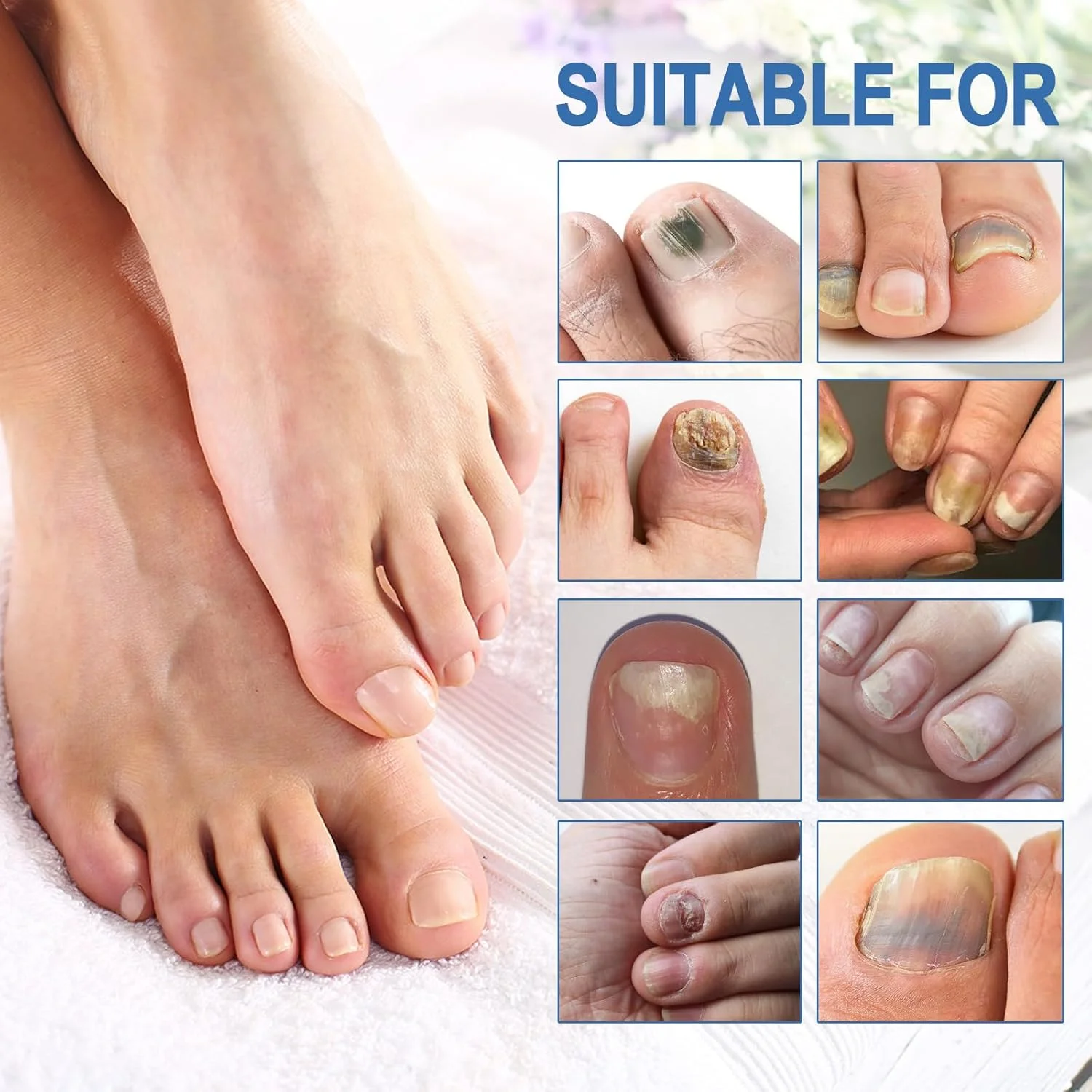 قلم مراقبت و درمان ناخن پا، فرمول قوی برای ناخن های ضخیم، شکسته، تغییر رنگ داده و آسیب دیده (4 عدد)