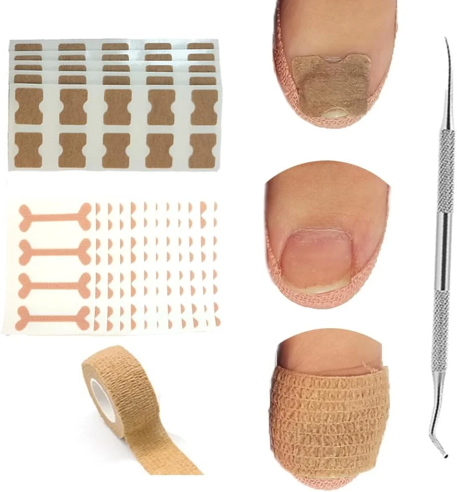 ابزار درمان ناخن فرورفته در گوشت، کیت رفع ناخن فرورفته در گوشت، 50 عدد برچسب اصلاح ناخن فرورفته در گوشت، 50 عدد پد اصلاح کننده ناخن پا، 1 عدد سوهان و بالابر ناخن پا، 1 رول محافظ انگشت پا بدون چسب
