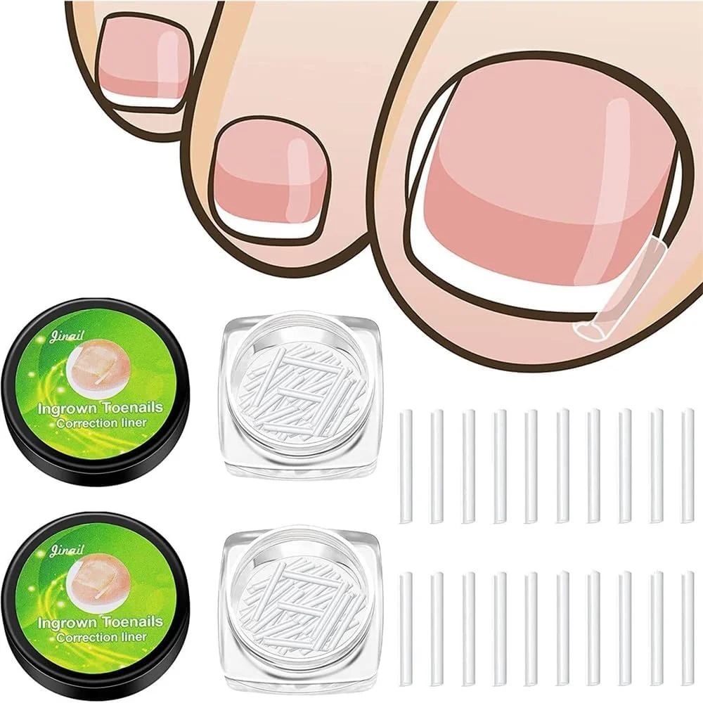 کیت درمان حرفه ای اصلاح ناخن پا فرو رفته، نوارهای صاف کننده اصلاح کننده ناخن پا فرو رفته، ابزار پدیکور ناخن پا فرو رفته (بسته 100 عددی)