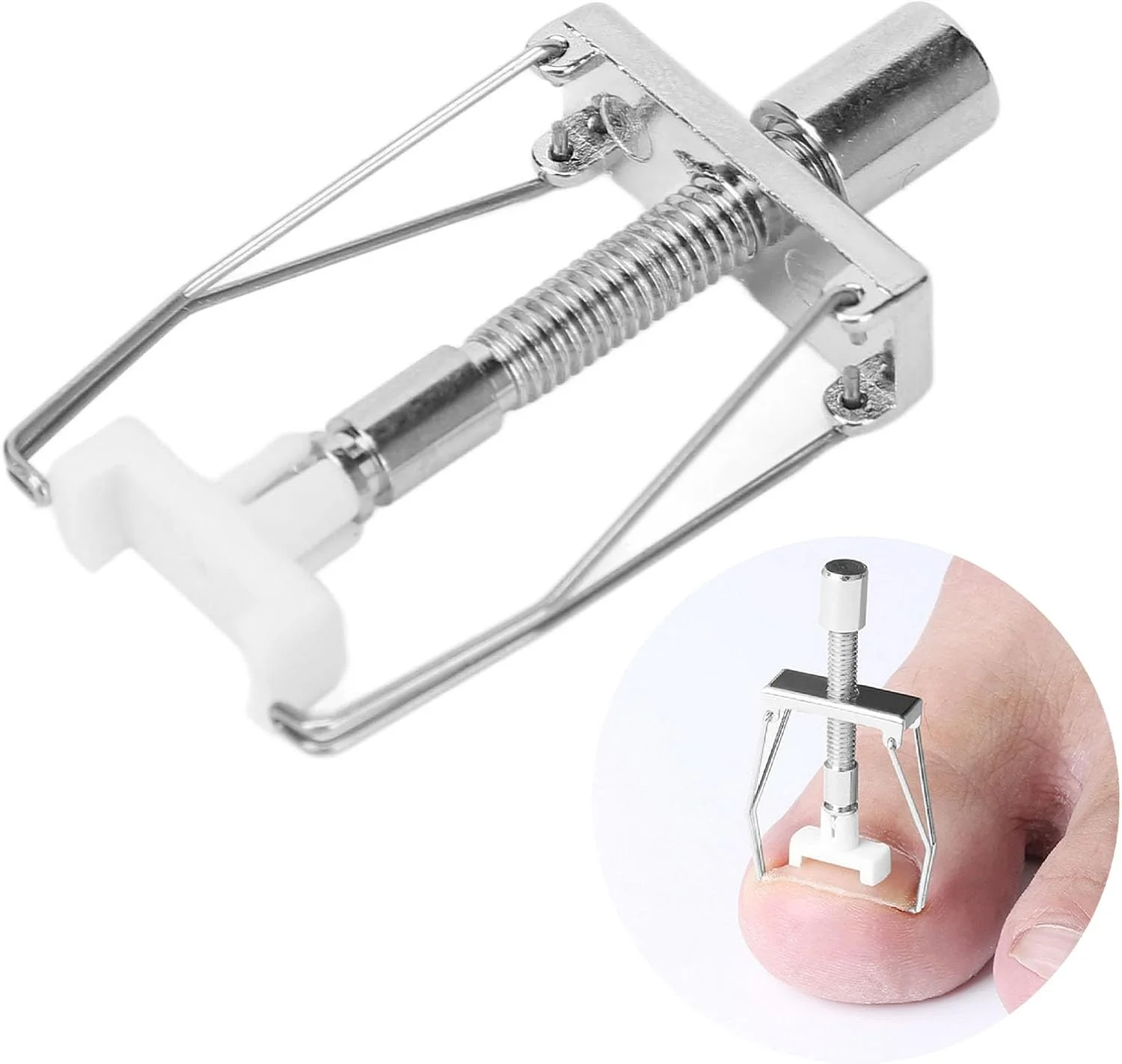 کیت درمان حرفه ای ناخن پا فرورفته، اصلاح کننده ناخن استیل ضد زنگ با 12 بریس، تسکین سریع برای ناخن های پا فرورفته