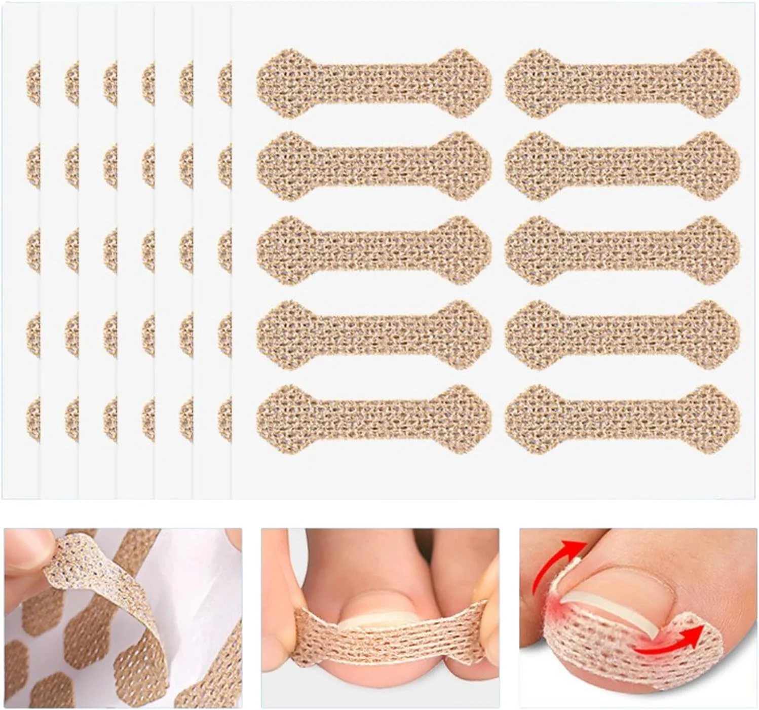 درمان ناخن فرورفته اوبابو، 100 عدد نوار تنفسی برای ناخن فرورفته، ابزار بدون درد برای ناخن فرورفته، پدیکور حرفه ای برای ناخن فرورفته، پچ اصلاح کننده ناخن (100 عدد)