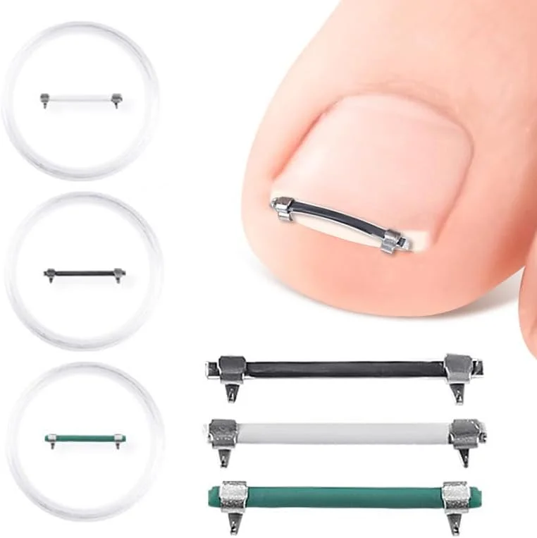 ابزار اصلاح ناخن پا فرورفته، 3 عدد نوار درمانی ناخن پا فرورفته، گیره های درج نوار، ابزار پدیکور صاف کننده ناخن پا برای ترمیم ناخن های خمیده