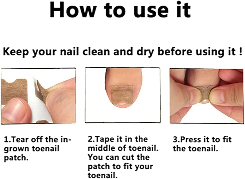 ابزار درمان ناخن فرورفته در گوشت، کیت رفع ناخن فرورفته در گوشت، 50 عدد برچسب اصلاح ناخن فرورفته در گوشت، 50 عدد پد اصلاح کننده ناخن پا، 1 عدد سوهان و بالابر ناخن پا، 1 رول محافظ انگشت پا بدون چسب