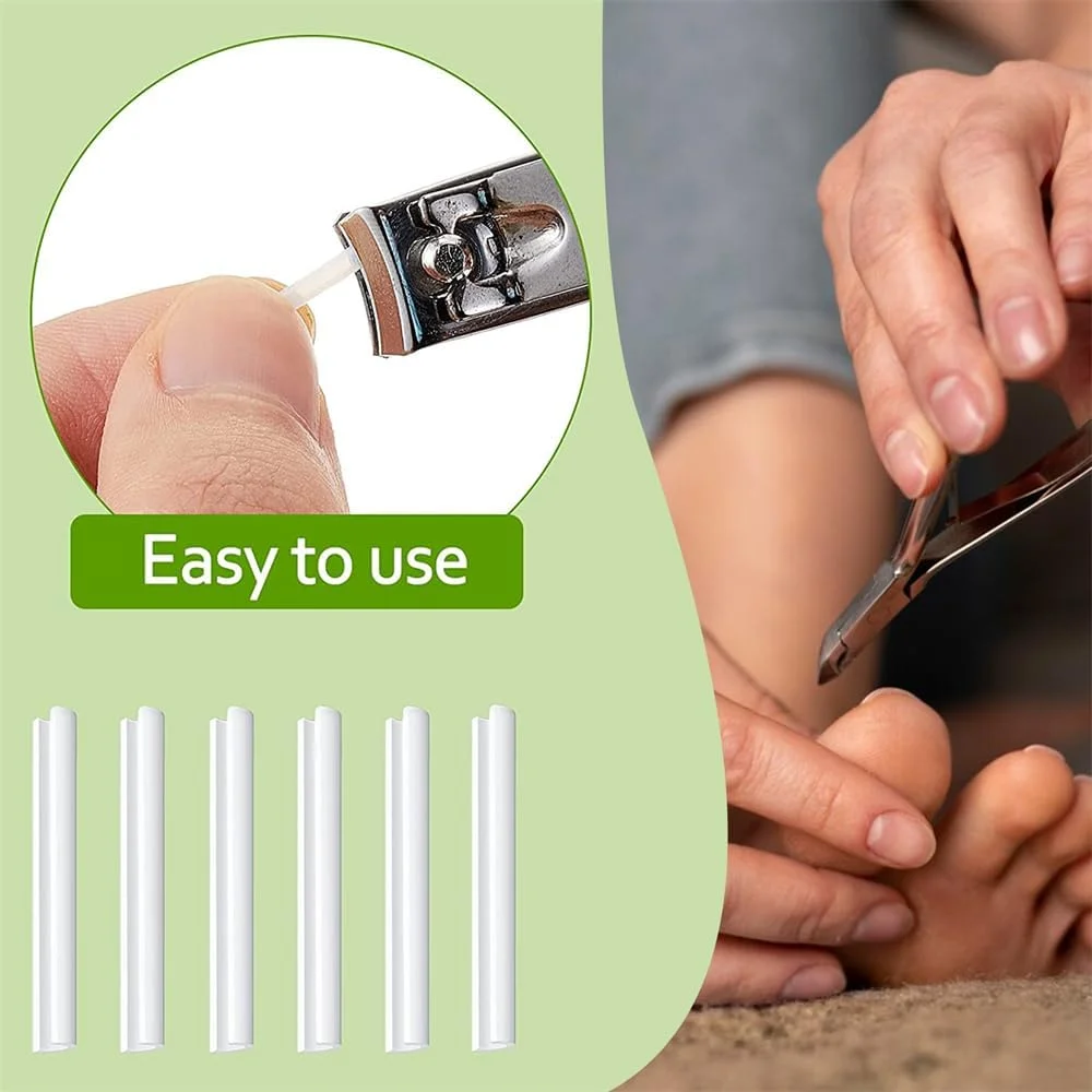 کیت درمان حرفه ای اصلاح ناخن پا فرو رفته، نوارهای صاف کننده اصلاح کننده ناخن پا فرو رفته، ابزار پدیکور ناخن پا فرو رفته (بسته 100 عددی)
