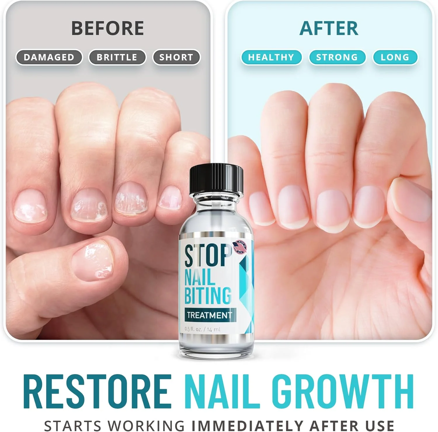 محلول جلوگیری از جویدن ناخن - لاک ناخن بیرنگ با طعم تلخ برای جلوگیری از جویدن ناخن - استفاده آسان و ایمن برای کودکان - محلول تقویت کننده ناخن - مراقبت از ناخن برای رشد سالم ناخن (۱۵ میلی لیتر)