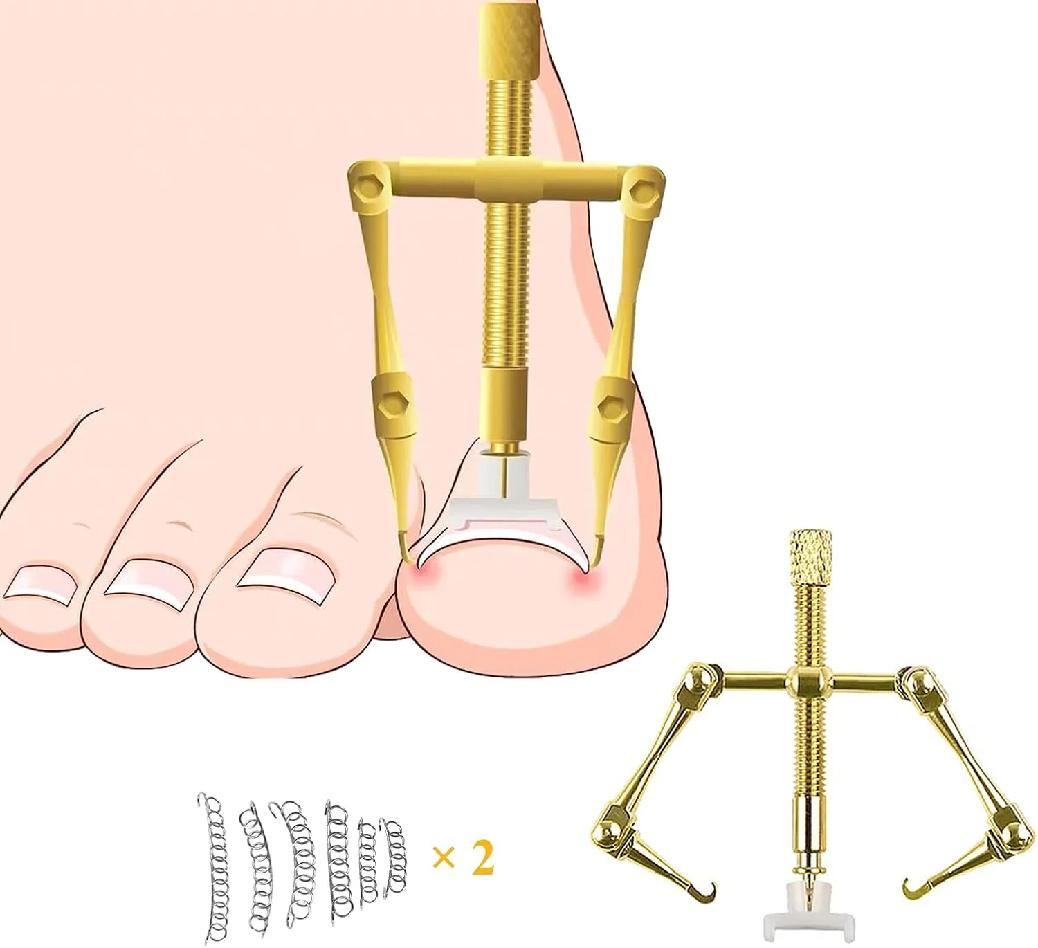 کیت درمان ناخن فرورفته MAKINGTEC با 12 بریس ناخن، لیفتر ناخن فرورفته مسی خالص، ابزار مراقبت از پا فولادی برای پارونیشیا کیت درمان ناخن فرورفته MAKINGTEC با 12 بریس ناخن، لیفتر ناخن فرورفته مسی خالص، ابزار مراقبت از پا فولادی برای پارونیشیا